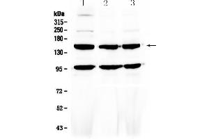 Western blot analysis of VEGF Receptor 3 using anti-VEGF Receptor 3 antibody . (FLT4 抗体)