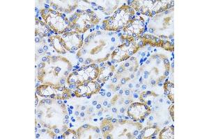 Immunohistochemistry of paraffin-embedded mouse kidney using PEX5 antibody (ABIN6133015, ABIN6145469, ABIN6145471 and ABIN6221464) at dilution of 1:100 (40x lens). (PEX5 抗体  (AA 1-260))