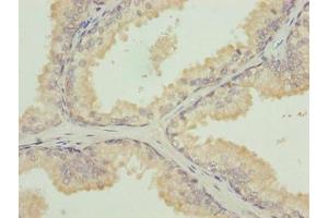 Immunohistochemistry (IHC) image for anti-Tubulin, beta 1 (TUBB1) (AA 270-451) antibody (ABIN7173675)