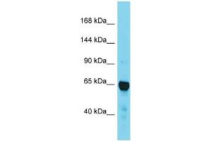 Western Blotting (WB) image for anti-Transforming, Acidic Coiled-Coil Containing Protein 2 (TACC2) (C-Term) antibody (ABIN2788943) (TACC2 抗体  (C-Term))