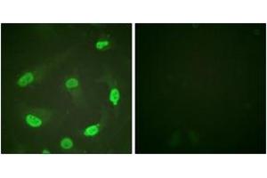 Immunofluorescence (IF) image for anti-Tumor Protein P53 (TP53) (AA 344-393), (acLys381) antibody (ABIN1535528)