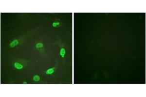 Immunofluorescence analysis of HeLa cells, using p53 (Acetyl-Lys379) Antibody. (p53 抗体  (acLys381))