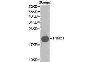 Western Blotting (WB) image for anti-Cardiac Troponin C (TNNC1) antibody (ABIN1875147) (TNNC1 抗体)
