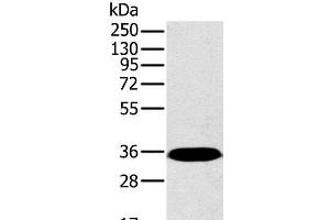 Western Blot analysis of Mouse brain tissue using PPP2CA Polyclonal Antibody at dilution of 1:450 (PPP2CA 抗体)