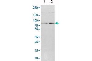 Western blot analysis of cell lysates with DNAJC14 polyclonal antibody  at 1:250-1:500 dilution. (DNAJC14 抗体)