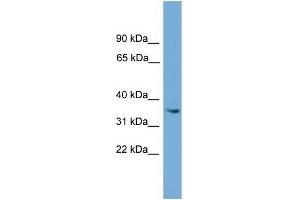 ASB17 antibody used at 1 ug/ml to detect target protein.