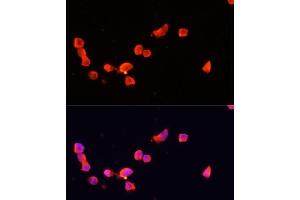 Immunofluorescence analysis of SH-SY5Y cells using CDK5R1 antibody (ABIN7266592) at dilution of 1:100. (CDK5R1 抗体  (AA 99-307))