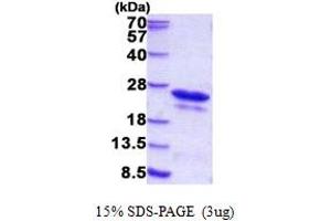 SDS-PAGE (SDS) image for Cold Shock Domain Containing C2, RNA Binding (CSDC2) (AA 1-153) protein (His tag) (ABIN5852940)