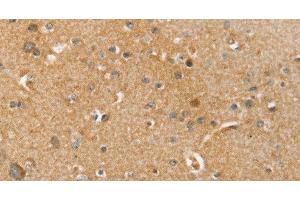 Immunohistochemistry of paraffin-embedded Human brain tissue using SLC41A2 Polyclonal Antibody at dilution 1:45 (SLC41A2 抗体)