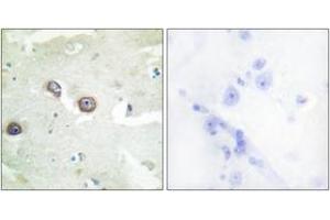 Immunohistochemistry analysis of paraffin-embedded human brain tissue, using CDH4 Antibody. (Cadherin 4 抗体  (AA 731-780))