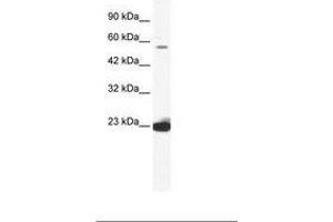 Image no. 1 for anti-DEAD (Asp-Glu-Ala-Asp) Box Polypeptide 55 (DDX55) (AA 468-517) antibody (ABIN202800) (DDX55 抗体  (AA 468-517))