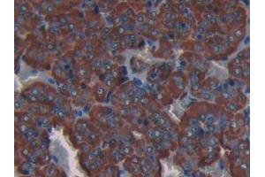 Immunohistochemistry (IHC) image for anti-Collagen, Type III, alpha 1 (COL3A1) (AA 1171-1435) antibody (ABIN7435409)