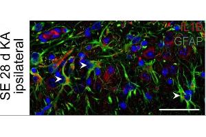 Immunostaining of mouse hippocampal CA1 region showing GFAP and IL1B labeling of astrocytes 28 days after KA-induced status epilepticus (SE). (GFAP 抗体  (AA 411-422))