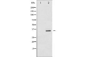 Western blot analysis of CDK2 expression in A2780 whole cell lysates,The lane on the left is treated with the antigen-specific peptide. (CDK2 抗体  (Internal Region))