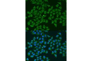 Immunofluorescence (IF) image for anti-Nitric Oxide Synthase 2, Inducible (NOS2) (AA 500-730) antibody (ABIN6144728)