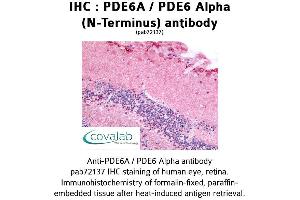 Image no. 1 for anti-phosphodiesterase 6A, CGMP-Specific, Rod, alpha (PDE6A) (N-Term) antibody (ABIN1737917)