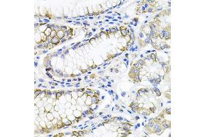 Immunohistochemistry of paraffin-embedded human stomach using ACVR2A antibody. (ACVR2A 抗体)