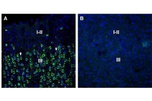 Immunohistochemistry (IHC) image for anti-Sortilin-Related Receptor, L(DLR Class) A Repeats Containing (SORL1) (AA 652-665), (Extracellular) antibody (ABIN7043770)