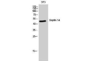 Western Blotting (WB) image for anti-Septin 14 (SEPT14) (C-Term) antibody (ABIN3180873) (Septin 14 抗体  (C-Term))