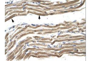 Image no. 1 for anti-Homeobox A10 (HOXA10) (N-Term) antibody (ABIN202418) (HOXA10 抗体  (N-Term))