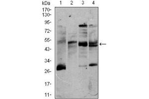 Western blot analysis using CD5 antibody against K562 (1), Jurkat (2), Raji (3), and MOLT4 (4) cell lysate. (CD5 抗体  (AA 27-233))