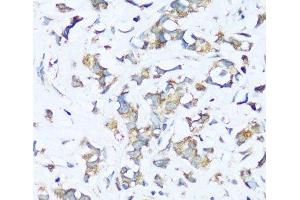 Immunohistochemistry (Paraffin-embedded Sections) (IHC (p)) image for anti-ATP Synthase, H+ Transporting, Mitochondrial F0 Complex, Subunit E (ATP5I) antibody (ABIN7259374)