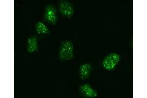 IF analysis of KIFC1 using anti-KIFC1 antibody (ABIN7599523).