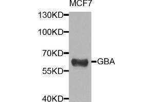 Western blot analysis of extracts of MCF-7 cells, using GBA antibody (ABIN5974589) at 1/1000 dilution. (GBA 抗体)