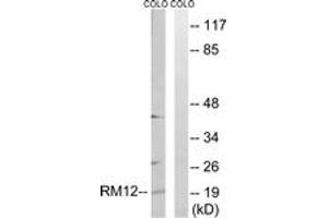Western Blotting (WB) image for anti-Mitochondrial Ribosomal Protein L12 (MRPL12) (AA 31-80) antibody (ABIN2890047) (MRPL12 抗体  (AA 31-80))