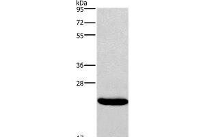 Western Blot analysis of Riji cell using IFNA16 Polyclonal Antibody at dilution of 1:400 (IFNA16 抗体)