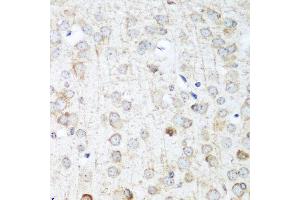 Immunohistochemistry of paraffin-embedded mouse brain using ANKRD52 antibody at dilution of 1:100 (40x lens). (ANKRD52 抗体)