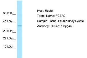 Host: Rabbit Target Name: FCER2 Sample Type: Fetal Kidney lysates Antibody Dilution: 1.