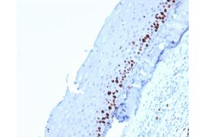 Immunohistochemistry (IHC) image for anti-Antigen Identified By Monoclonal Antibody Ki-67 (MKI67) (AA 2293-2478) antibody (ABIN6940053)