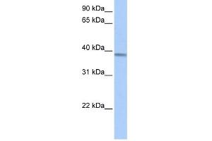 ACADSB antibody used at 1 ug/ml to detect target protein. (ACADSB 抗体  (Middle Region))
