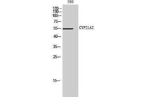 Western Blotting (WB) image for anti-Cytochrome P450, Family 21, Subfamily A, Polypeptide 2 (CYP21A2) (Internal Region) antibody (ABIN6281044) (CYP21A2 抗体  (Internal Region))