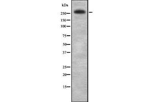 Western blot analysis IGF2R using Jurkat whole cell lysates (IGF2R 抗体  (C-Term))