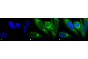 Immunocytochemistry/Immunofluorescence analysis using Mouse Anti-GRP78 Monoclonal Antibody, Clone 1H11-1H7 (ABIN863112). (GRP78 抗体)
