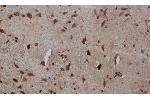 Immunohistochemistry of paraffin-embedded Human brain tissue using PIK3CB Polyclonal Antibody at dilution 1:50 (PIK3CB 抗体)