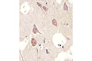 Immunohistochemistry (Paraffin-embedded Sections) (IHC (p)) image for anti-Cholinergic Receptor, Muscarinic 2 (CHRM2) antibody (ABIN6242476)