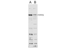 Western Blotting (WB) image for anti-SECIS Binding Protein 2 (SECISBP2) (Internal Region) antibody (ABIN2466241) (SECISBP2 抗体  (Internal Region))