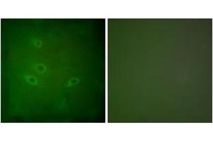 Immunofluorescence analysis of HeLa cells, using CARD6 Antibody. (CARD6 抗体  (AA 1-50))