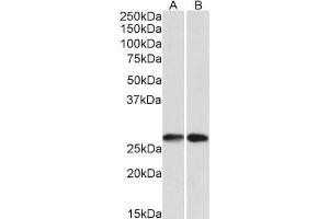 Western Blotting (WB) image for anti-Nicotinamide N-Methyltransferase (NNMT) antibody (ABIN5903827) (NNMT 抗体)