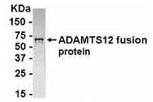 Western Blotting (WB) image for anti-ADAM Metallopeptidase with thrombospondin Type 1 Motif, 12 (ADAMTS12) (AA 297-446) antibody (ABIN2468193) (ADAMTS12 抗体  (AA 297-446))