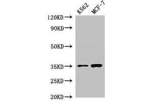 Western Blot Positive WB detected in: K562 whole cell lysate, MCF-7 whole cell lysate All lanes: EN2 antibody at 2. (EN2 抗体  (AA 1-251))