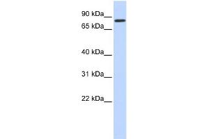 WB Suggested Anti-AMOT Antibody Titration:  0. (Angiomotin 抗体  (N-Term))