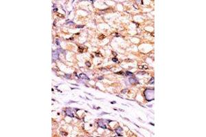 Image no. 2 for anti-CTD (Carboxy-terminal Domain, RNA Polymerase II, Polypeptide A) Small Phosphatase 1 (CTDSP1) (AA 1-250), (C-Term), (N-Term) antibody (ABIN360805) (CTDSP1 抗体  (C-Term, N-Term))
