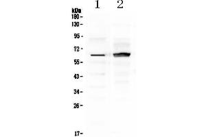 Western blot analysis of Frizzled 4 using anti-Frizzled 4 antibody . (FZD4 抗体)