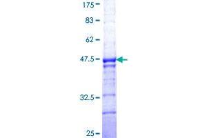 Image no. 1 for Basonuclin 1 (BNC1) (AA 599-705) protein (GST tag) (ABIN1346796)