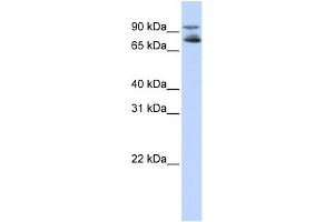 WB Suggested Anti-FOXK2 Antibody Titration:  0. (Forkhead Box K2 抗体  (Middle Region))