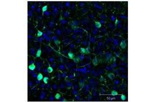 Immunofluorescence Microscopy of GFP-GOAT-Antibody. (GFP 抗体)